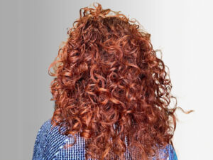 12_applicazioni-riccio